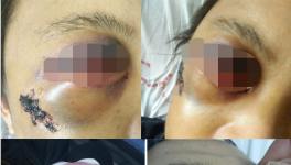 快訊 | 華潤水泥分廠發(fā)生事故?。ǜ綀D）